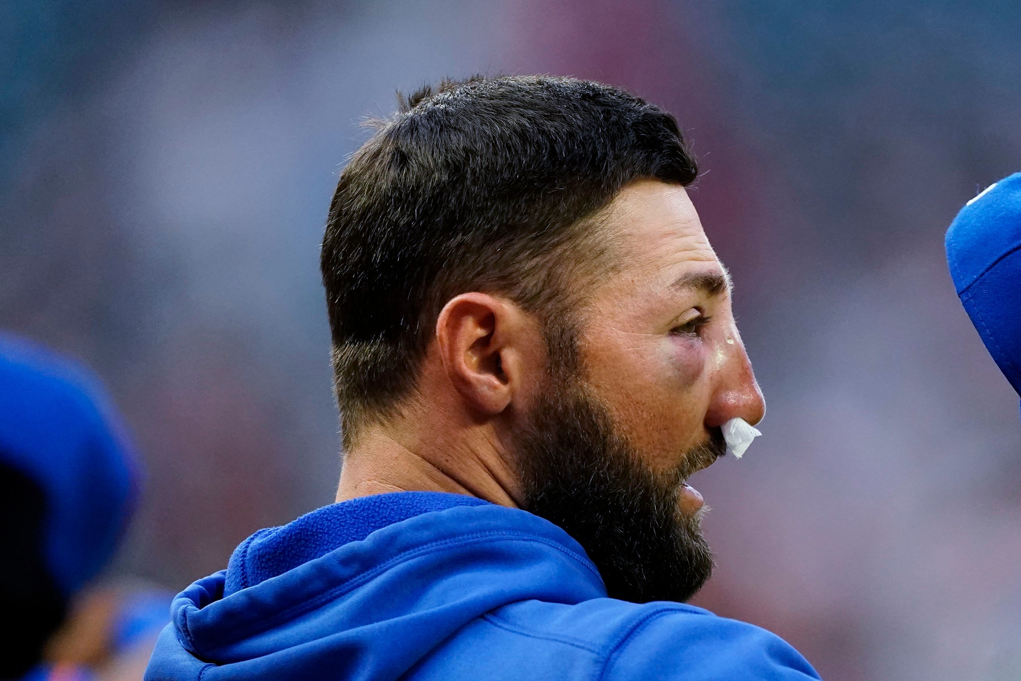 Kevin Pillar takes fastball to face, tweets he's 'fine' after Mets